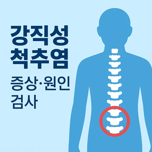 강직성 척추염 증상,원인,검사