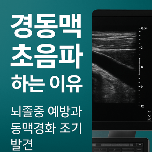 경동맥 초음파 하는 이유