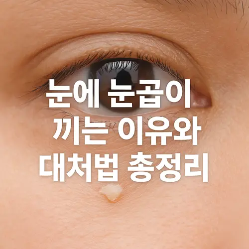 눈에 눈곱이 끼는 이유