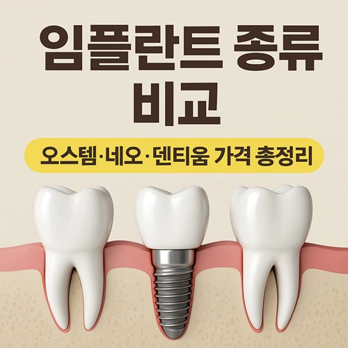 임플란트 종류별 비교 오스템 네오 텐티움 가격
