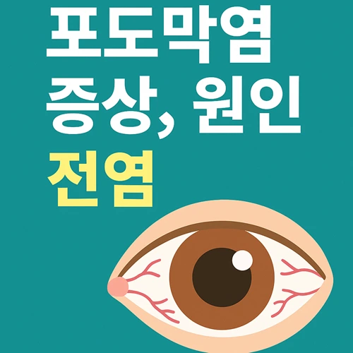 포도막염 증상,원인,전염