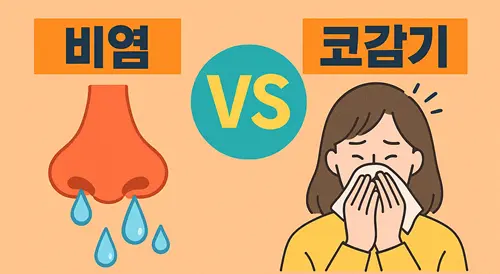 비염 vs 코감기 구분법