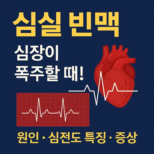 심실 빈맥(VT) 심전도 특징·원인·증상